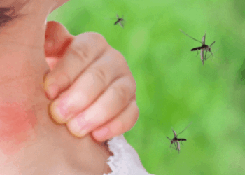 Nëse hani këto ushqime, mushkonjat do t’ju rrinë larg