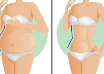 Këshilla kundër dhjamit në bark