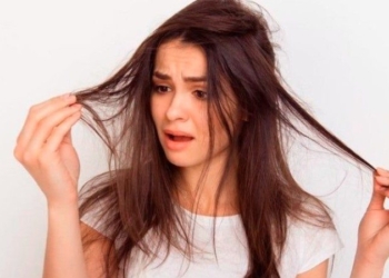 Mënyra më e lehtë për të shpëtuar nga flokët e yndyrshëm