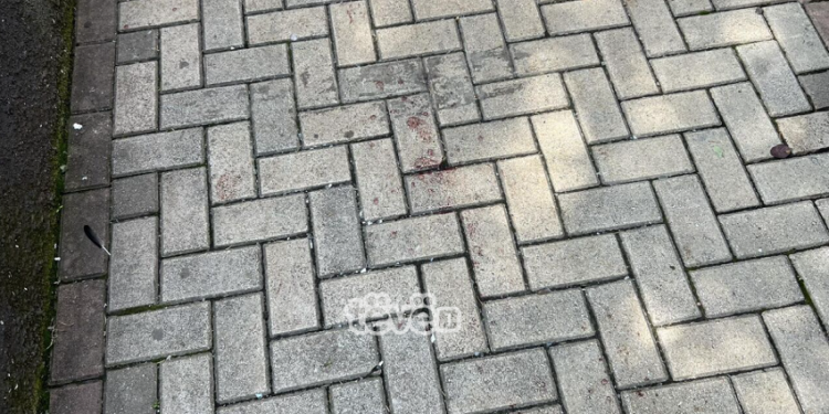 ShSKUK jep detaje të reja për personat që u lënduan mbrëmë në “Bon Vivant”