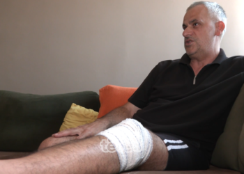 Kafshimi nga qeni gati ia “mori” këmbën