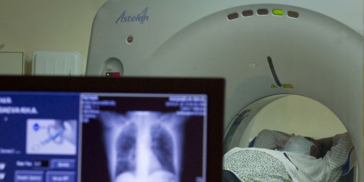 Studimi i ri: “COVID-i i gjatë” mund të shkaktojë anomali në organet kryesore