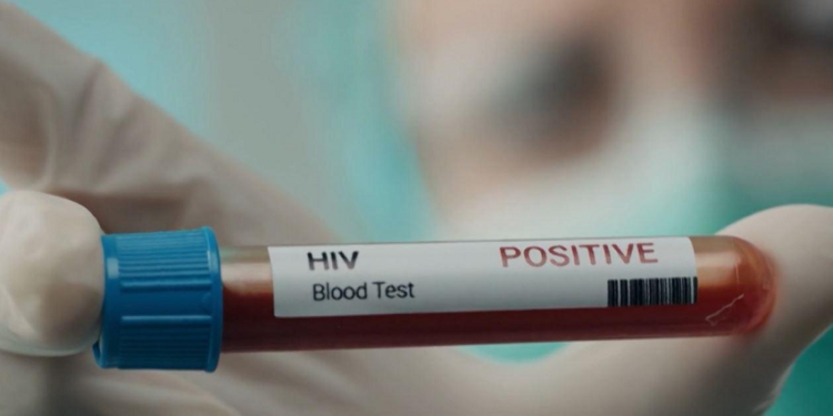 10 raste të reja me HIV në Kosovë