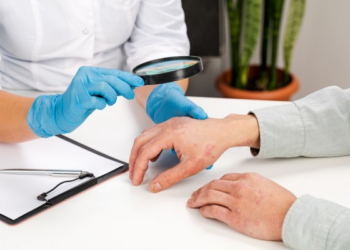 ​Dita Botërore e Psoriazës, një sëmundje autoimune e lidhur me sëmundje të tjera