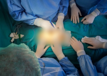 811 raste të thyerjes së gurëve në veshkë për nëntë muaj në QKUK