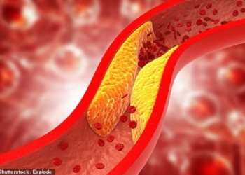 ​Zbulohet vaksina “premtuese” për uljen e kolesterolit