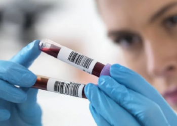 Analizat e gjakut tregojnë nëse organet plaken shpejt apo ngadalë