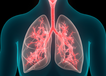 Çfarë ndodh kur ushqimi hyn në mushkëri?