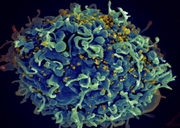 ​Shkencëtarët eliminojnë me sukses HIV nga qelizat