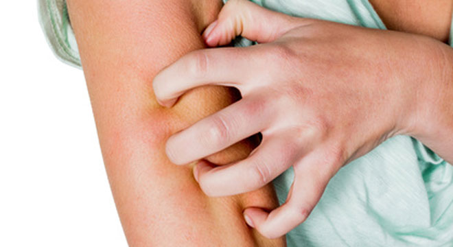 Trajtimi i zgjebes, dermatologia Kokollari: Pacientët reagojnë keq dhe ndihen të stigmatizuar