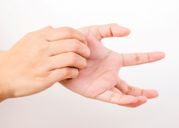 Një skuqje e zakonshme në duar dhe këmbë mund të jetë shenjë e një gjendjeje të pakëndshme të lëkurës