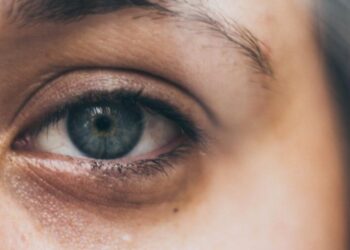 Rrathët e zinj nuk formohen vetëm nga pagjumësia