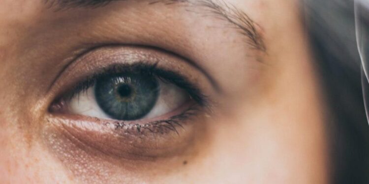 Rrathët e zinj nuk formohen vetëm nga pagjumësia