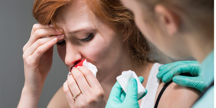 Përse duhet të frikësoheni nëse ju rrjedh gjak nga hunda!