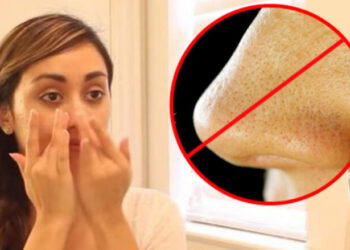 Lirohuni nga pikat e zeza dhjamore në hundë me vetëm tri veprime