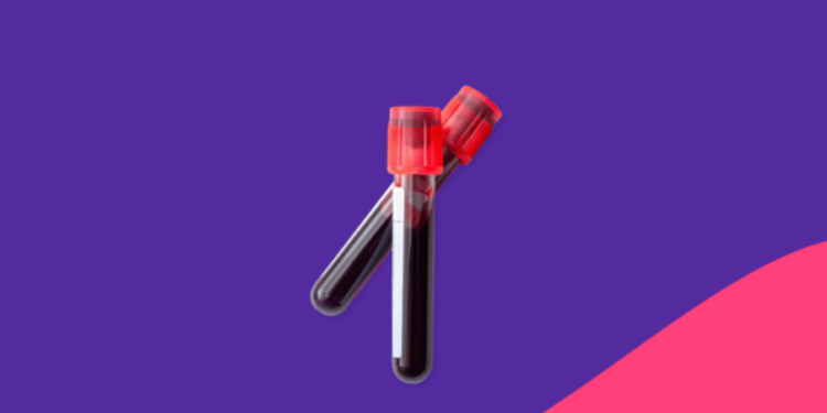 Çfarë mund të ndodhë me trupin nëse e teproni me marrjen e kalciumit