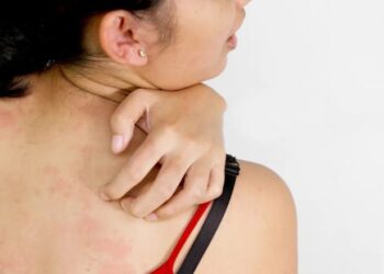 Çfarë problemesh i shkakton vera lëkurës?