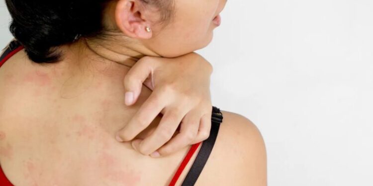 Çfarë problemesh i shkakton vera lëkurës?