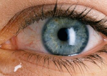 Tensioni i syrit – shkaqet, shenjat dhe kur duhet të shkoni patjetër te mjeku