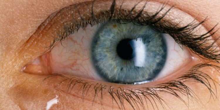 Tensioni i syrit – shkaqet, shenjat dhe kur duhet të shkoni patjetër te mjeku