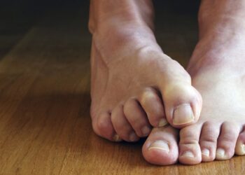 Katër mënyra si të parandaloni djersitjen e këmbëve gjatë verës