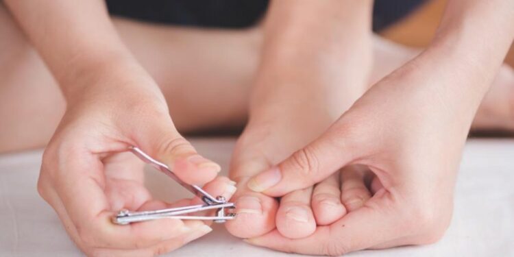 Thonjtë që rriten në mish – Si të kujdeseni në mënyrën e duhur?