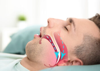 Çfarë është apnea e gjumit dhe cilat janë simptomat?