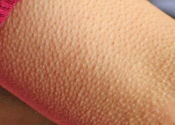 ​ Kur ndjeni ethe në trup – Çfarë tregojnë për shëndetin