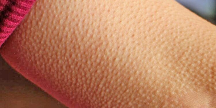 ​ Kur ndjeni ethe në trup – Çfarë tregojnë për shëndetin