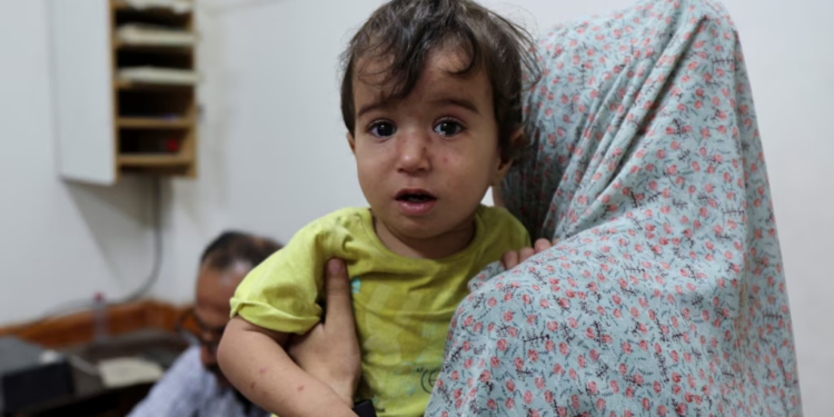 OBSH: Arrihet pajtim për pauza të shkurtra në luftime në Gazë për vaksinim kundër poliomielitit