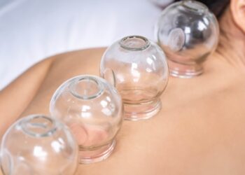 Çfarë është terapia me kupa? Problemet shëndetësore që trajton