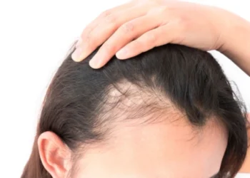 Tri veprimet që parandalojnë rënien e flokëve