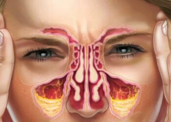 Gjërat që duhet të dini për kujdesin ndaj sinuseve