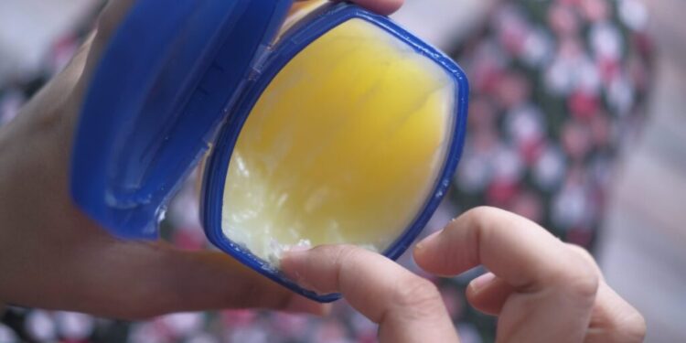 Nga se përbëhet vazelina? – Përfitimet dhe përdorimet