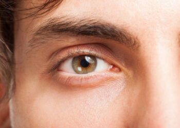 Sinjalet paralajmëruese të anemisë në trupin tuaj