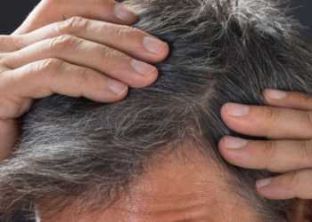 Stresi dhe thinjat e flokëve – si mund të riktheni ngjyrën e tyre?