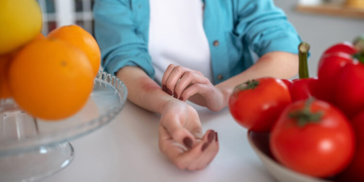  Ushqimet që nuk e dini se shkaktojnë alergji