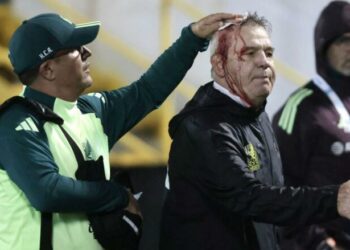 Trajneri i njohur u mbulua me gjak pasi u godit në kokë pas ndeshjes