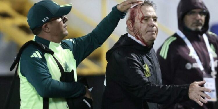 Trajneri i njohur u mbulua me gjak pasi u godit në kokë pas ndeshjes