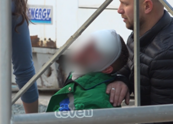 Si ndodhi shpërthimi i bombolës së gazit në autolarje që la të lënduar dy punëtorë?