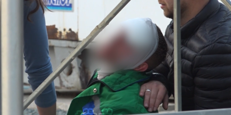 Si ndodhi shpërthimi i bombolës së gazit në autolarje që la të lënduar dy punëtorë?