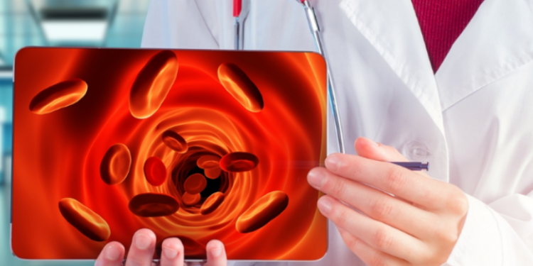 Simptomat që mund të tregojnë mungesën e hekurit