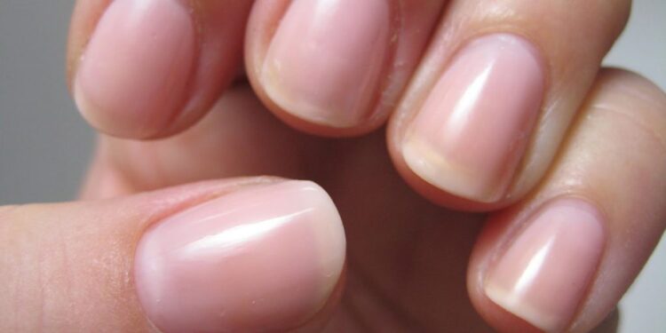 Kujdesi i duhur për thonjtë gjatë dimrit – metodat natyrale në shtëpi