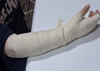 Mësuesja raportohet të ketë rrahur 10-vjeçaren nga Çairi në Shkup, vajza përfundon në spital