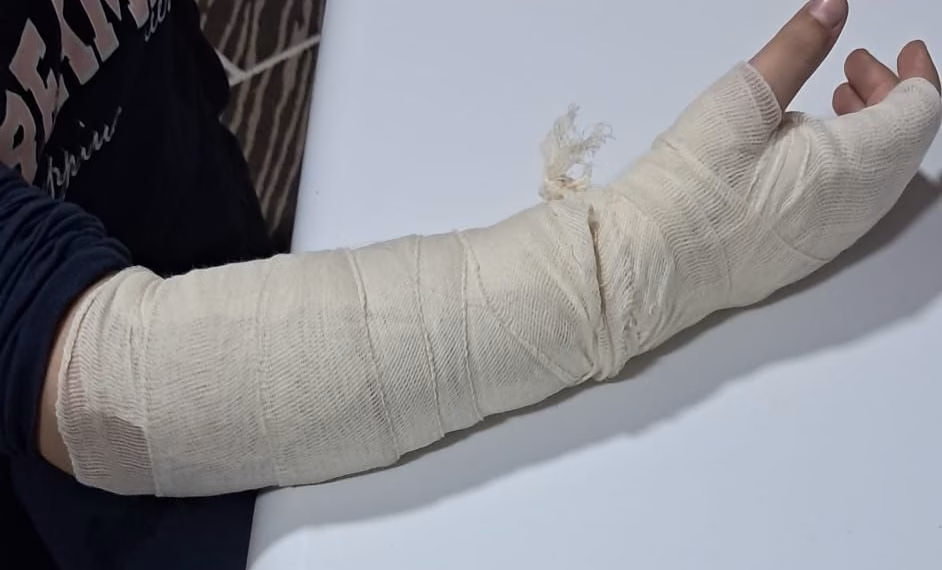 Mësuesja raportohet të ketë rrahur 10-vjeçaren nga Çairi në Shkup, vajza përfundon në spital