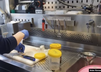 Pritje të gjata për rezultate në Institutin e Patologjisë