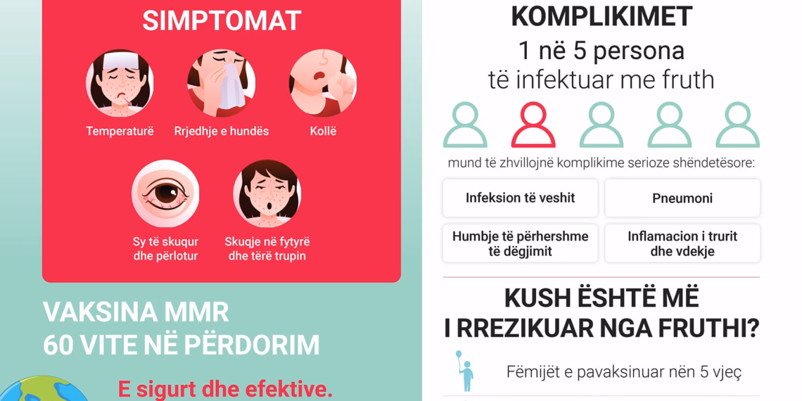 Nëntë raste të reja të fruthit brenda një jave në Kosovë