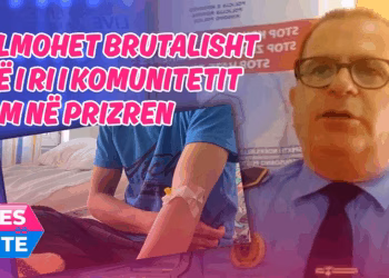 Sulmohet brutalisht një i ri i komunitetit rom në Prizren, policia jep detaje