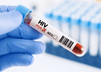 57 raste ditore me HIV në Filipine, kërkohet shpallje e emergjencës kombëtare