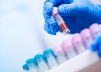 Testi i thjeshtë i gjakut parashikon rrezikun nga sëmundja e trashëguar e zemrës